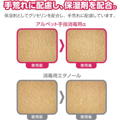 サラヤ アルペット手指消毒用アルファ 5L 41238